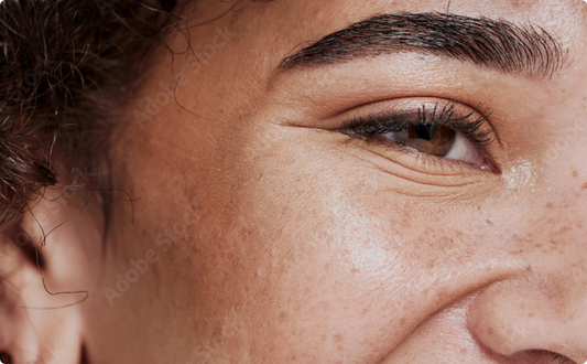 Signs Your Skin Is Dehydrated (Not Just Dry)
