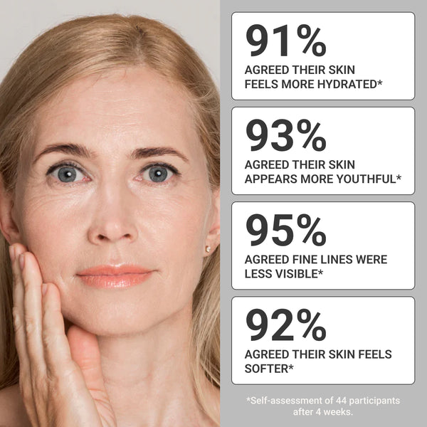 Retinol Serum consumer results graphic showing 91% reported more hydration, 93% more youthful skin, 95% fewer fine lines, and 92% softer skin.