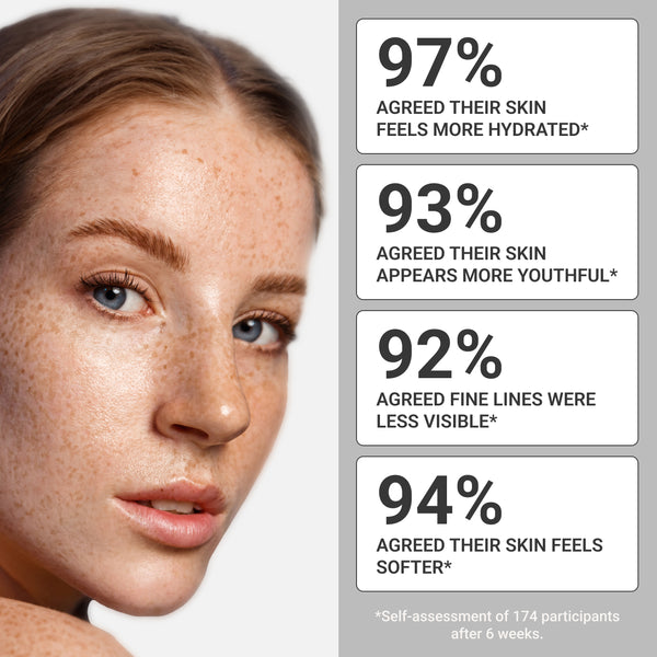a woman with freckles and a white background
